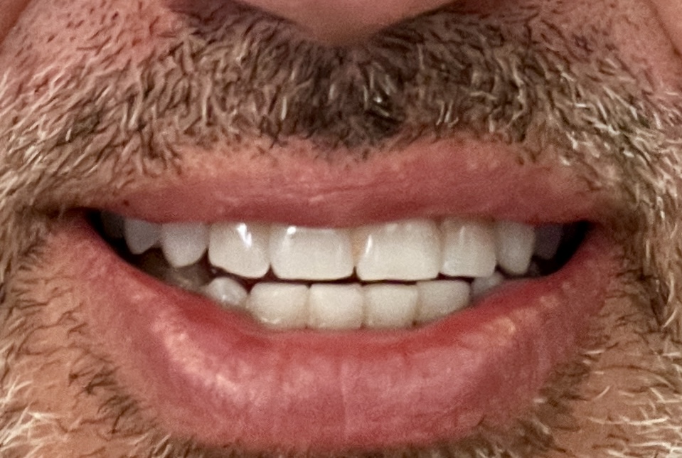 Brecknock Dental